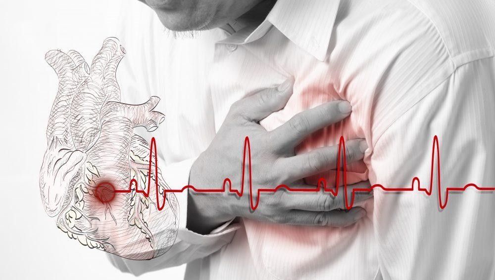 Сердечная недостаточность: причины, симптомы, лечение - МедКом