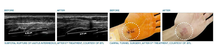medical background web banner Robotic scanning system before after 1685449829 original